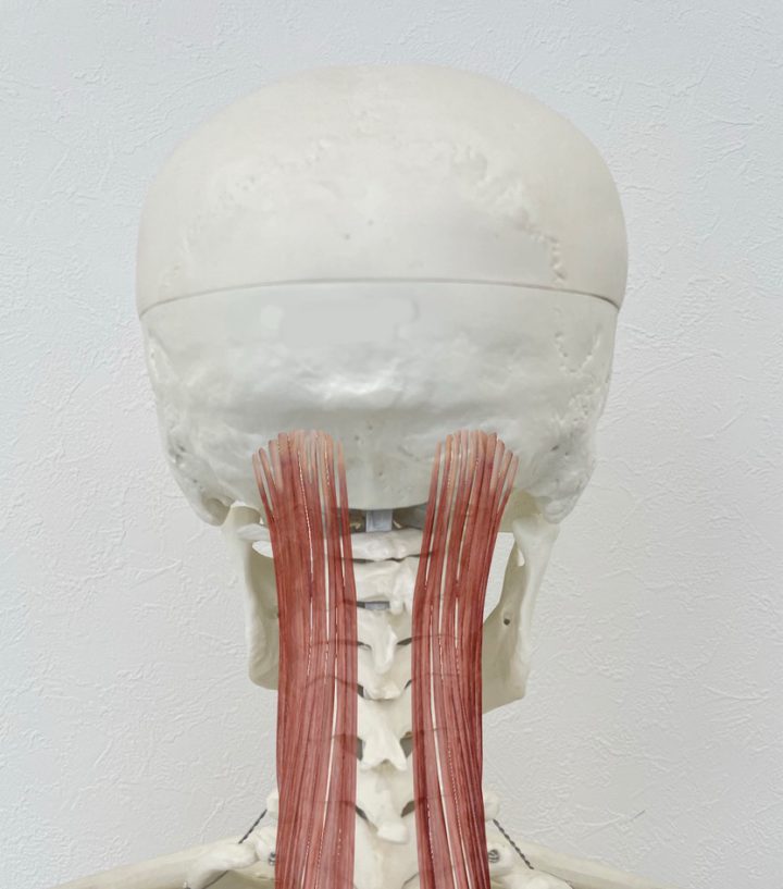 「頭痛」 パソコン仕事で10年前から慢性の頭痛 治療例紹介 名古屋トリガーポイント治療院