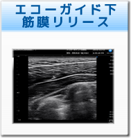 トリガーポイント治療