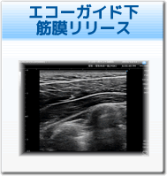 トリガーポイント治療