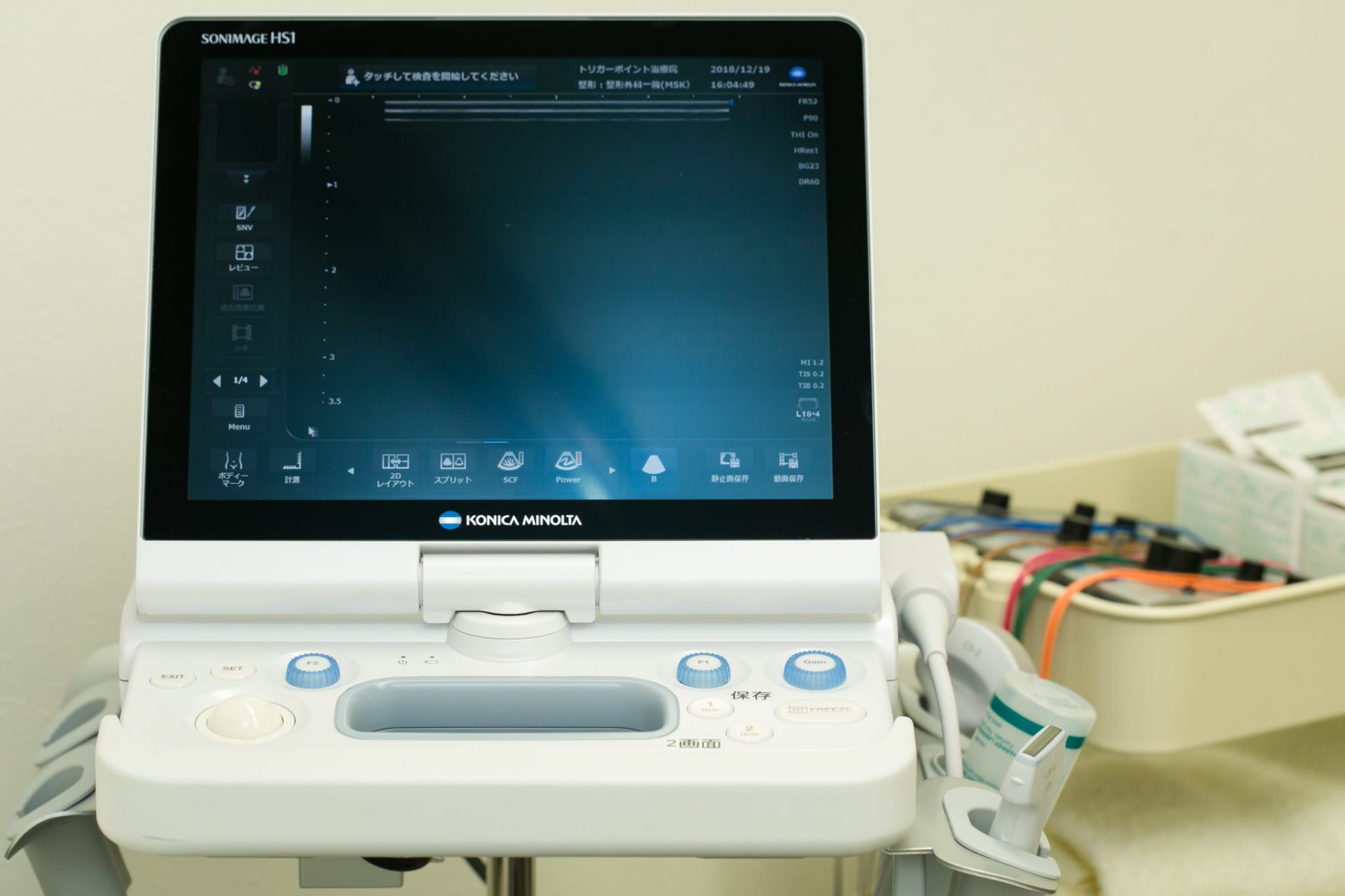 エコーを用いた安全で効果的なトリガーポイント鍼治療