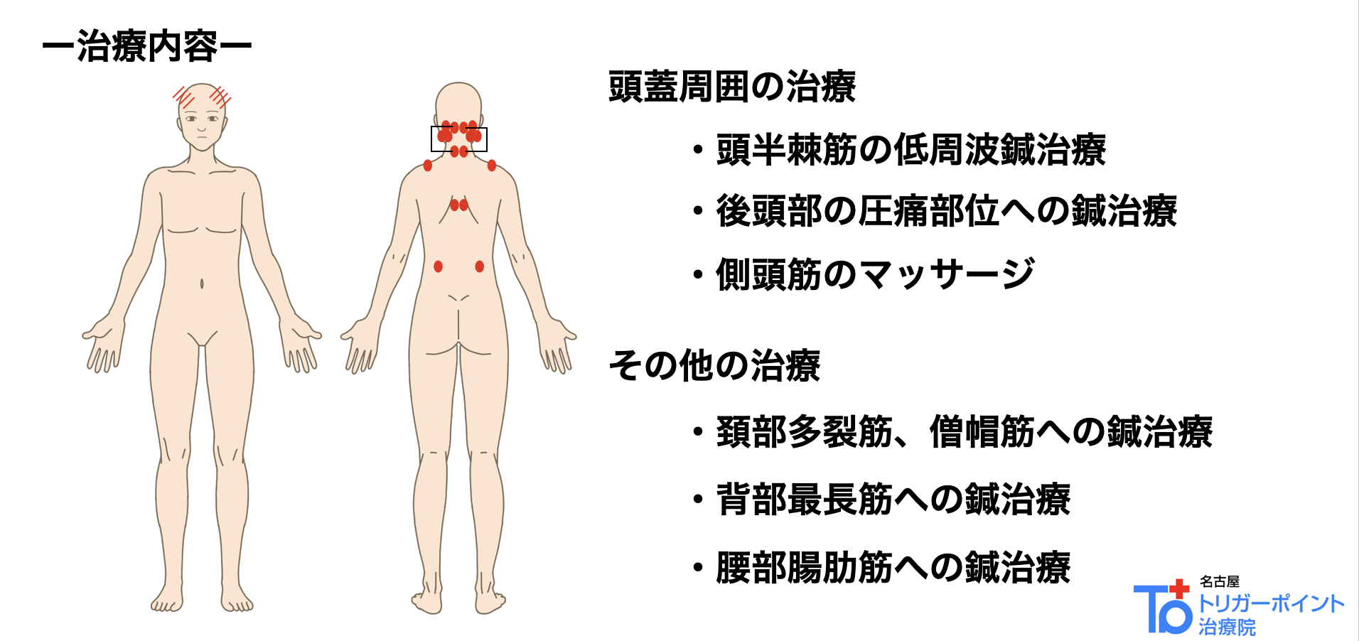 中腰姿勢で発症した膝外側の痛みの症例| 名古屋トリガーポイント